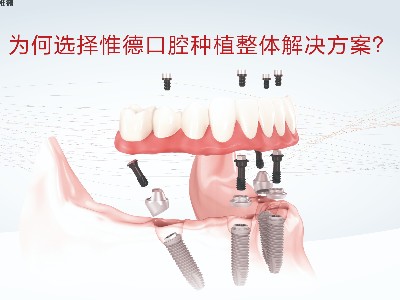 承德老人半口牙齒缺失怎么修復(fù) 承德老人半口牙齒缺失怎么修復(fù)